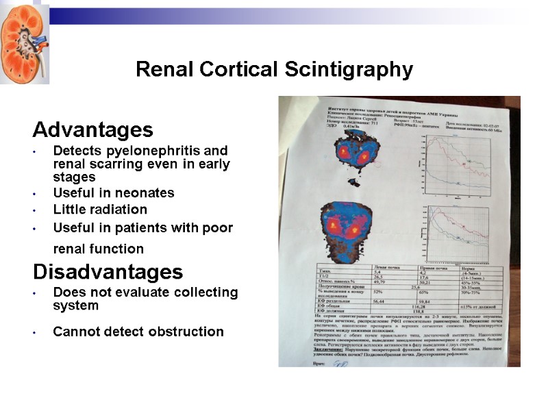 Renal Cortical Scintigraphy Advantages Detects pyelonephritis and renal scarring even in early stages 
